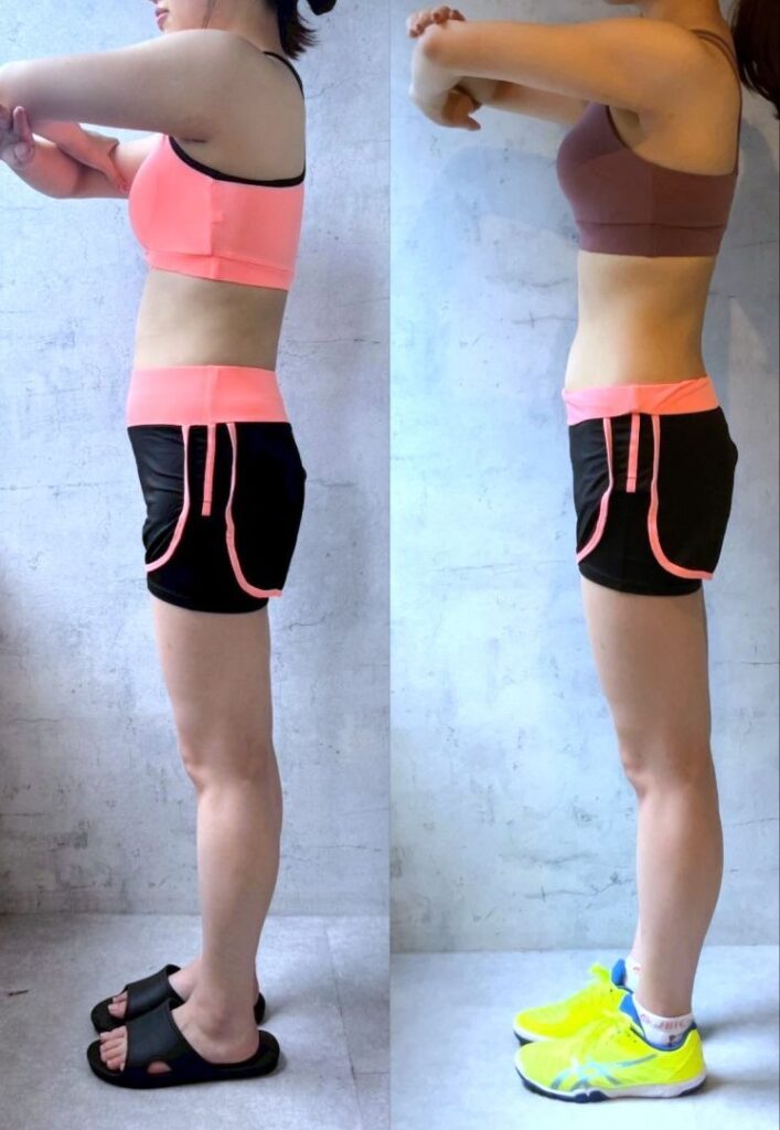 IMPROVEビフォーアフター(側面)